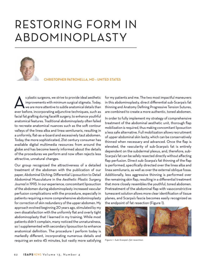 Restoring Form in Abdominoplasty. ISAPS News