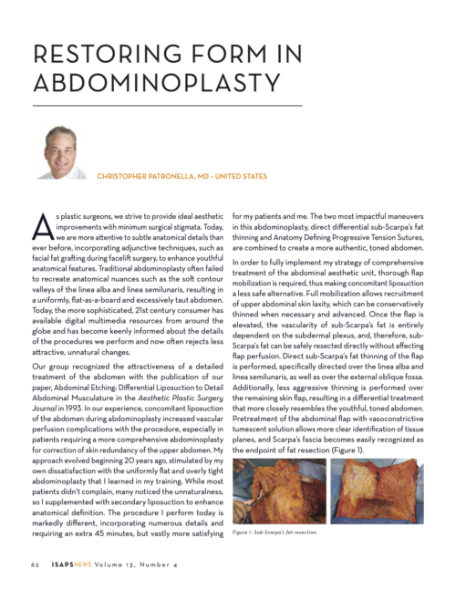 "Restoring Form in Abdominoplasty" | International Society Of Aesthetic Plastic Surgery News