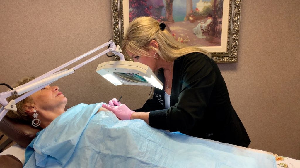 Tracy performs post-masectomy areola reconstruction for this breast cancer survivor.