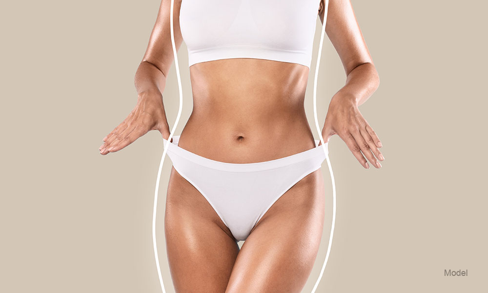 Do I Need to Lose Weight Before Getting Tummy Tuck Surgery?