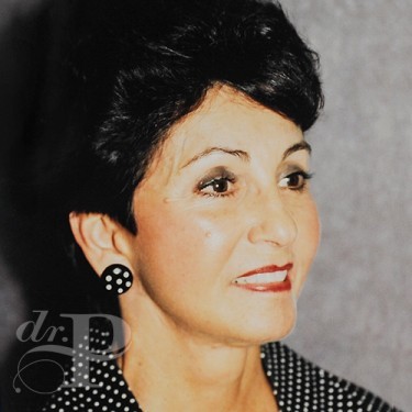 Case--29900 | After Brow Lift 3