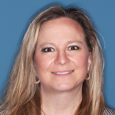 Case--36591 | After Facelift and Neck Lift 1